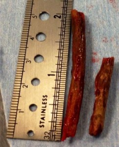 The size of the sticks embedded in Maisy's throat astonished even the doctors who removed them (credit: MSPCA-Angell)