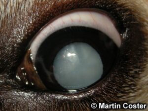 Cataract in the left eye of a diabetic dog.
