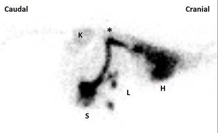 Figure 4 – Composite image of a trans-splenic portal scintigraphy in a dog with PSS. Compared with Figure 3, note that radiopharmaceutical uptake is identified at the injection site (S), then coursing dorsally and cranially in a shunt vessel (*), bypassing the liver (L) and entering the heart (H). Note that early uptake is seen in the systemic circulation and kidneys (K).