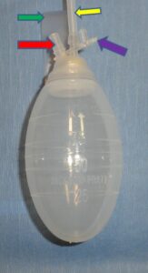 Figure 1: 100cc Jackson-Pratt Drain Reservoir, with attached drain tubing ( yellow arrow). The drain spout (red arrow) is opened by removing the attached plug (purple arrow). After removal of the plug, the volume of fluid is recorded using the milliliter (cc) scale marking on the reservoir. The fluid is emptied, the air squeezed from the reservoir, and the plug inserted to restore the vacuum. 