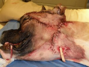 Figure 3: Facial reconstruction after major loss of skin overlying the left facial area (secondary to a skunk bite). Note the ¼ inch Penrose drain used to control the surgical dead-space created by elevation of the lower facial/cervical skin and transfer of a transposition flap from the lateral cervical area