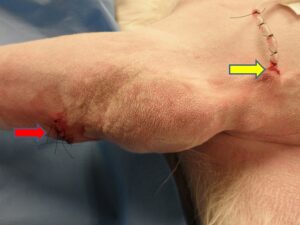 Figure 4C: Postoperative view of the hygroma. Note the non-fenestrated portion of the Jackson-Pratt Hemaduct drain exiting dorsal to the hygroma. The drain is secured to the skin with a purse-string knot and finger trap knot (yellow arrow). Note the lower access incision closed with interrupted skin sutures (red arrow).