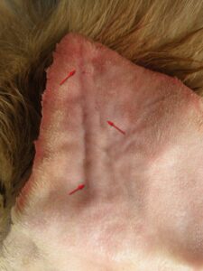 Figure 5B: Note the silhouette of the Jackson-Pratt Hemaduct drain (arrows) after insertion and activation of the vacuum reservoir.