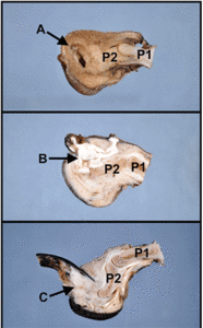 Figure 1: Three amputated canine digits from Angell, sectioned sagittally to demonstrate each lesion in relationship to the claw (oriented towards the left of each image) and the phalanges. In all images, portions of the first (P1) and second (P2) phalanx are evident, while the distal/third phalanx (P3) is partially to completely effaced by the pathologic processes. The lesions identified by arrows include a nailbed epithelial inclusion cyst (A), a keratoacanthoma (B), and a subungual squamous cell carcinoma (C). In this particular series, the claw is still intact with the squamous cell carcinoma (C) but is blunted to lost in the non-neoplastic and benign processes (A and B).