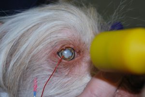 Figure 2: Electroretinography being performed for a diabetic cataract; there is a contact lens electrode on the cornea, one visible subcutaneous electrode, and the light source (yellow probe).
