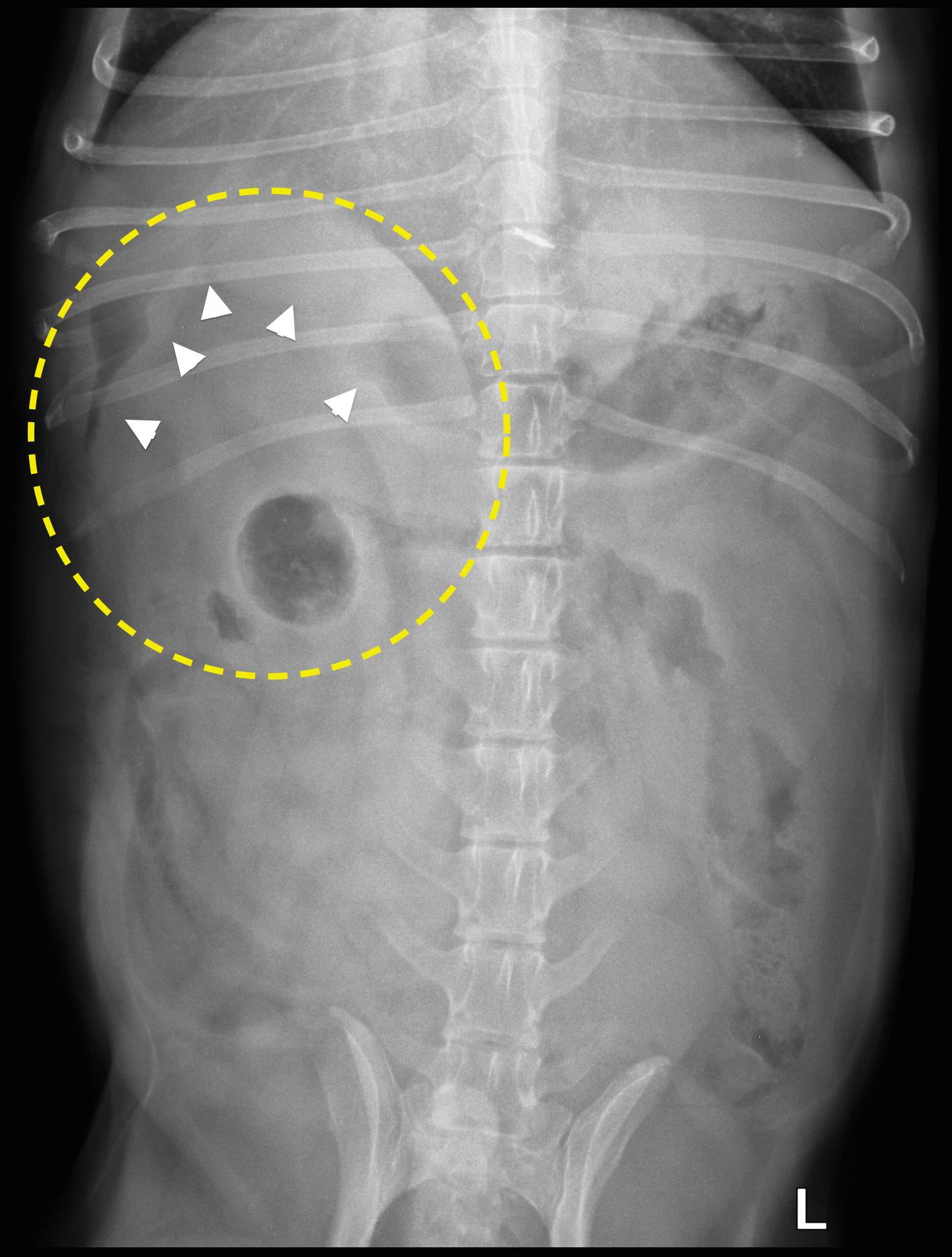 The Role of Imaging in Diagnosing Pancreatitis - MSPCA-Angell