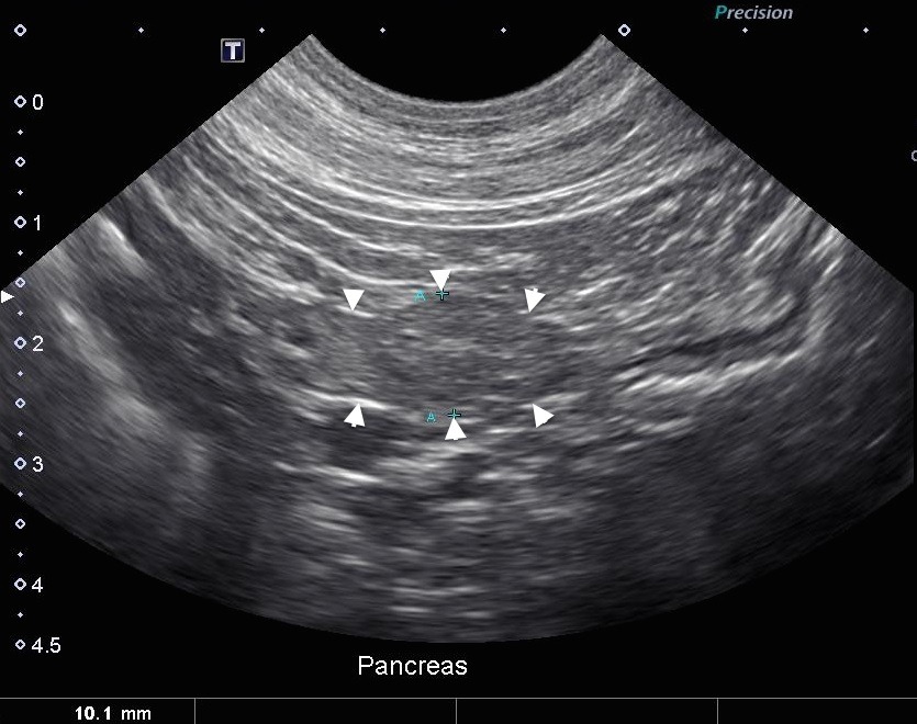 The Role of Imaging in Diagnosing Pancreatitis • MSPCAAngell