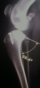 Image 1 Immediate postoperative lateral stifle radiograph in a seven-month-old male giant schnauzer with a tibial plateau angle of just over 30 degrees.