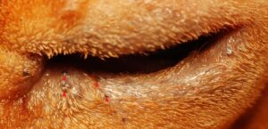 Figure 3: Left eye lid margin (red triangles marks, cystic lesions)