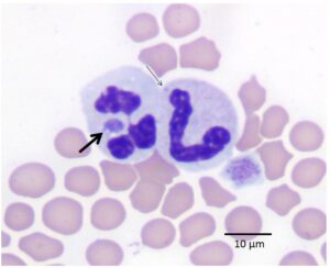 Figure 1 feline anaplasmosis