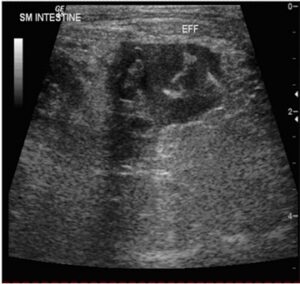 Figure 2 Small volume of a cellular effusion (ingesta)