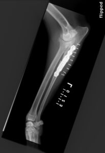 Lateral (figure 4) and AP (figure 5) postoperative radiographs of Pendo’s radius/ulna. Note the significant degenerative joint disease in the elbow.