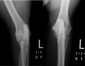 Image 2 – Slight differences in obliquity result in dramatic differences in visibility of lesions. On the left, somewhat obliqued craniocaudal view of an elbow. On the right, straight craniocaudal view of the same elbow, showing fairly severe flexor enthesiopathy and medial coronoid fragmentation.