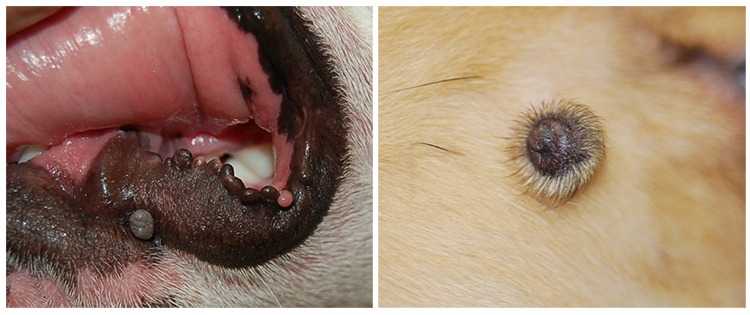 papilloma vs lipoma