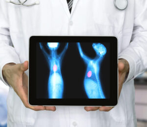 thoracic-radiography-imaging-cardiovascular-structures