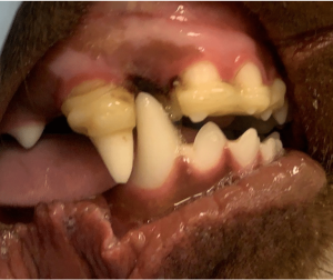 close up with orthodontic device