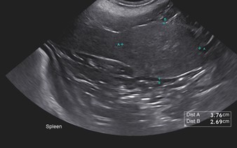 209817Utility of Ultrasound in Diagnosis of Hepatobiliary and Splenic Disease in Dogs